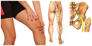 skausmas nugaros ir kojų gydymas