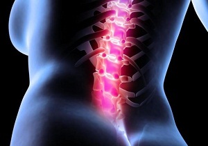 priežastys nugaros skausmas