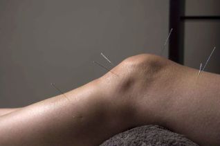Akupunktūra skatina sąnarių audinių atstatymą